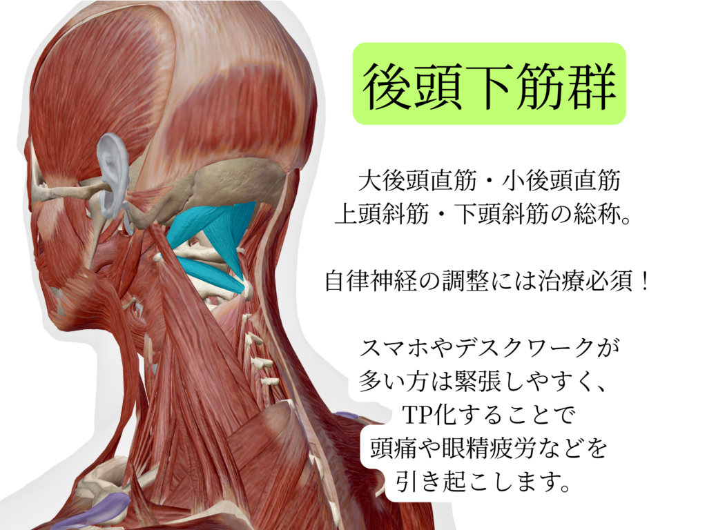 日野駅前やまぐち鍼治療院による後頭下筋群の説明の図。大後頭直筋、小後頭直筋、上頭斜筋、下頭斜筋の総称。自律神経の調整には治療必須。スマホやデスクワークが多い方は緊張しやすくTP化することで頭痛や眼精疲労などを引き起こします。
