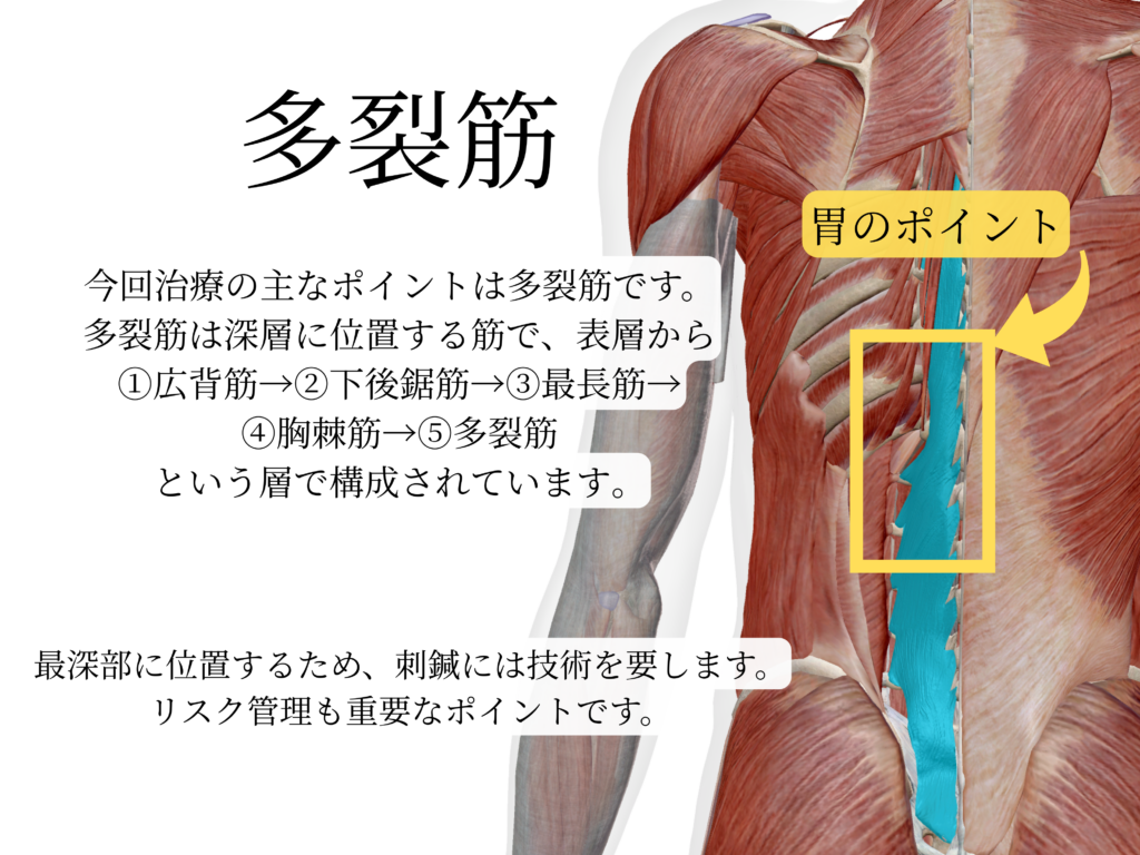 日野駅前やまぐち鍼治療院による、多裂筋の解説。胃のポイントの説明。